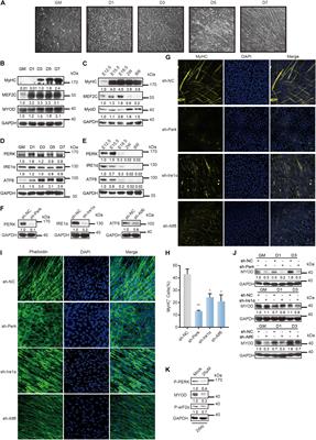 PERK Signaling Controls Myoblast Differentiation by Regulating MicroRNA Networks